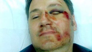Un estudiante y su madre golpearon ferozmente al director de la escuela