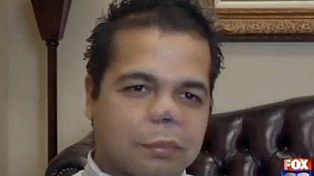 Se operó la nariz para levantar su moral tras un divorcio pero...