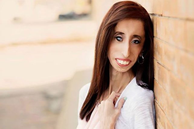 Conmovedor mensaje de la mujer “más fea del mundo”