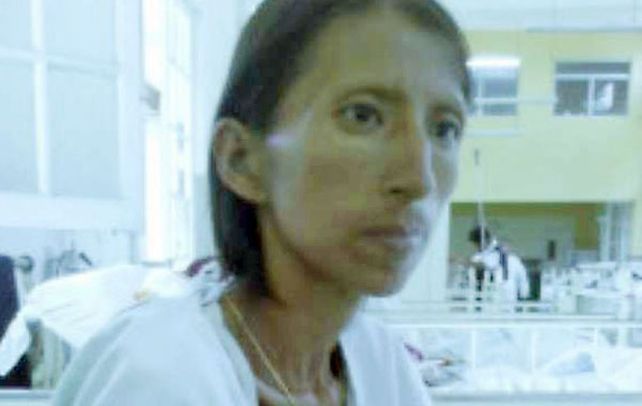 Penoso. Nela Kuja padece