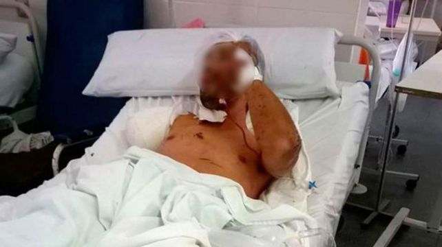 Demencial. El hombre de 25 años que fue atacado por el perro.
