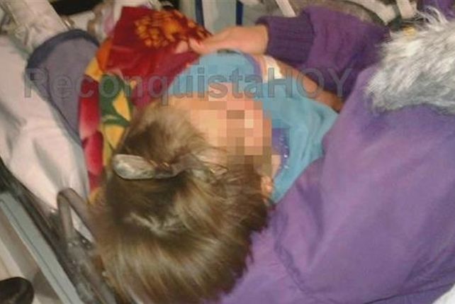 La bebé a la que le clavaron un tenedor en la cabeza fue operada y esperan por su evolución