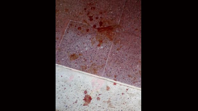Una discusión entre vecinos terminó con una mujer salvajemente golpeada