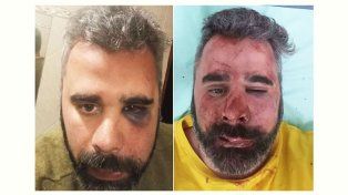 Le propinaron una brutal golpiza el presidente del Partido Libertario de Entre Ríos en San José. múltiples golpes le causaron contusiones en cuerpo y rostro