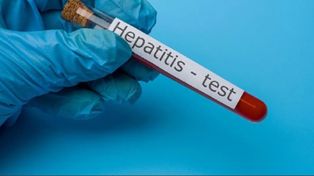 Un estudio científico vincula la hepatitis grave detectada en niños con el coronavirus