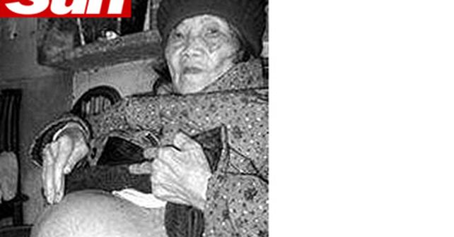 Una mujer china de 92 a&ntilde;os lleva un feto en su vientre desde hace 60 a&ntilde;os