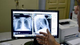 Desde el Ministerio de Salud de Entre Ríos hablaron acerca de las afecciones respiratorias y la forma de evitar complicaciones.