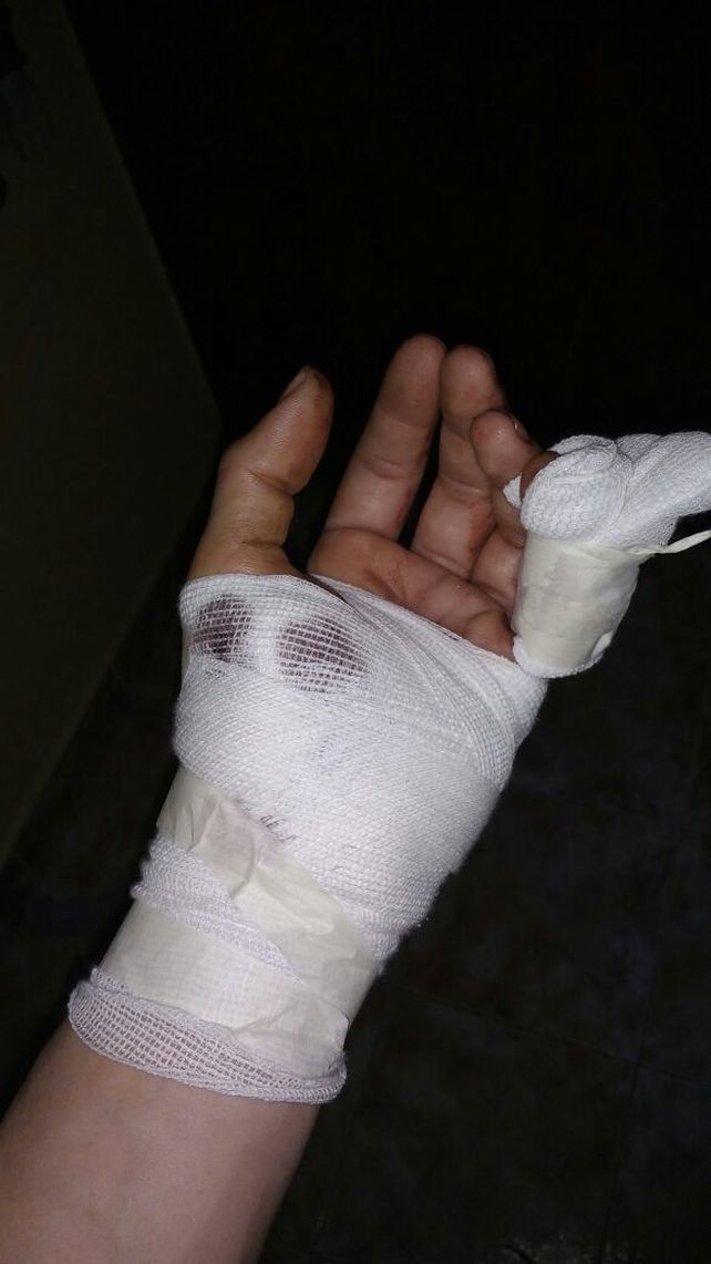 Grave lesión a un policía durante la aprehensión de un violento delincuente