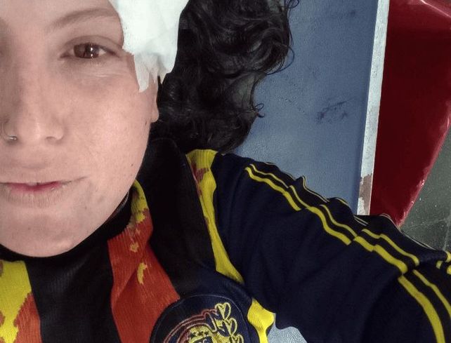 Brenda fue atacada por un piedrazo en Pellegrini y Callao tras los festejos de Central