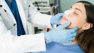 Labio leporino: la rinoplastia definitiva como clave para la calidad de vida