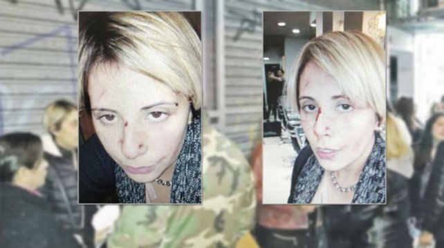 Le preguntó a su jefe cuándo iba a cobrar y fue brutalmente golpeada