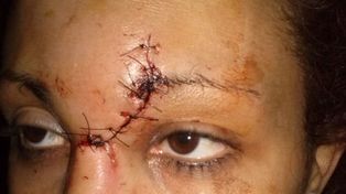 Una mujer golpeada publicó las fotos en Facebook y detuvieron al agresor