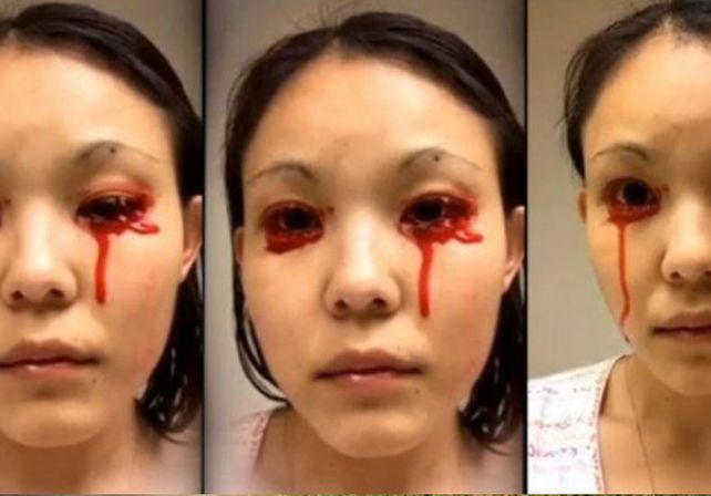 El increíble caso de la joven que llora sangre