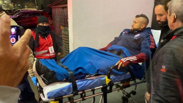 Arturo Vidal es retirado en camilla tras el encuentro de la roja ante Colombia.