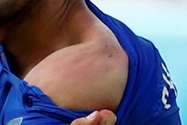 Un noruego gana 673 euros al apostar que Suárez mordería a alguien