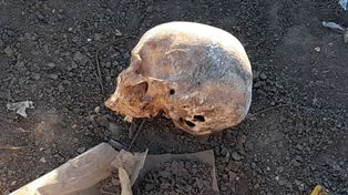 El cráneo encontrado en Colonia Avellaneda yacía junto a piezas dentarias y restos de yeso.&nbsp;