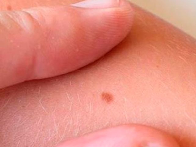 Vinculan los tratamientos contra la impotencia y el cáncer