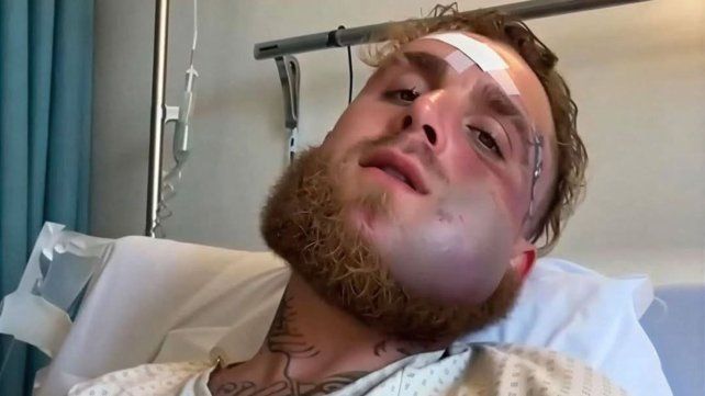 Así quedó el rostro de Jake Paul.
