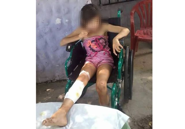 El ataque ocurrió el año pasado.