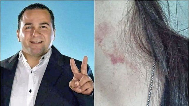 Concordia: malestar por el regreso del ex viceintendente denunciado por violencia de género.