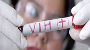 La OMS recomendó que cualquier positivo de VIH reciba tratamiento inmediato