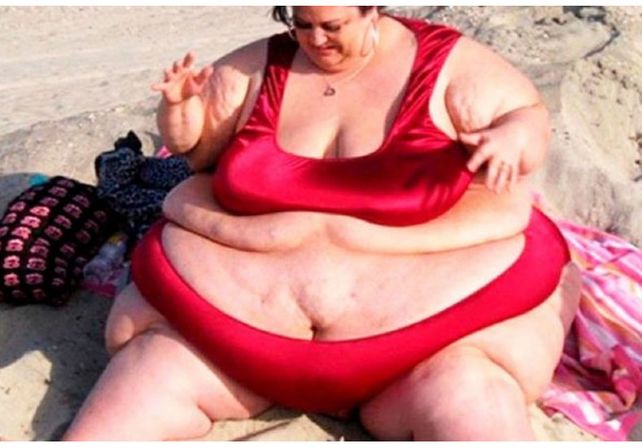 Terminó con su novio para poder bajar 100 kilos y salvar su vida