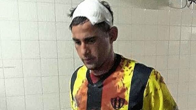 Un jugador de Wanderer´s terminó con un corte en el cuero cabelludo tras los incidentes.