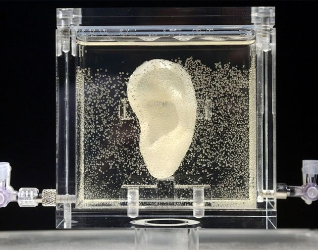 La oreja fue reconstruida a partir de las células de un descendiente.