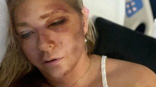 La mujer que acusó a Jeffrey Epstein tuvo un accidente y dice que le quedan pocos días de vida