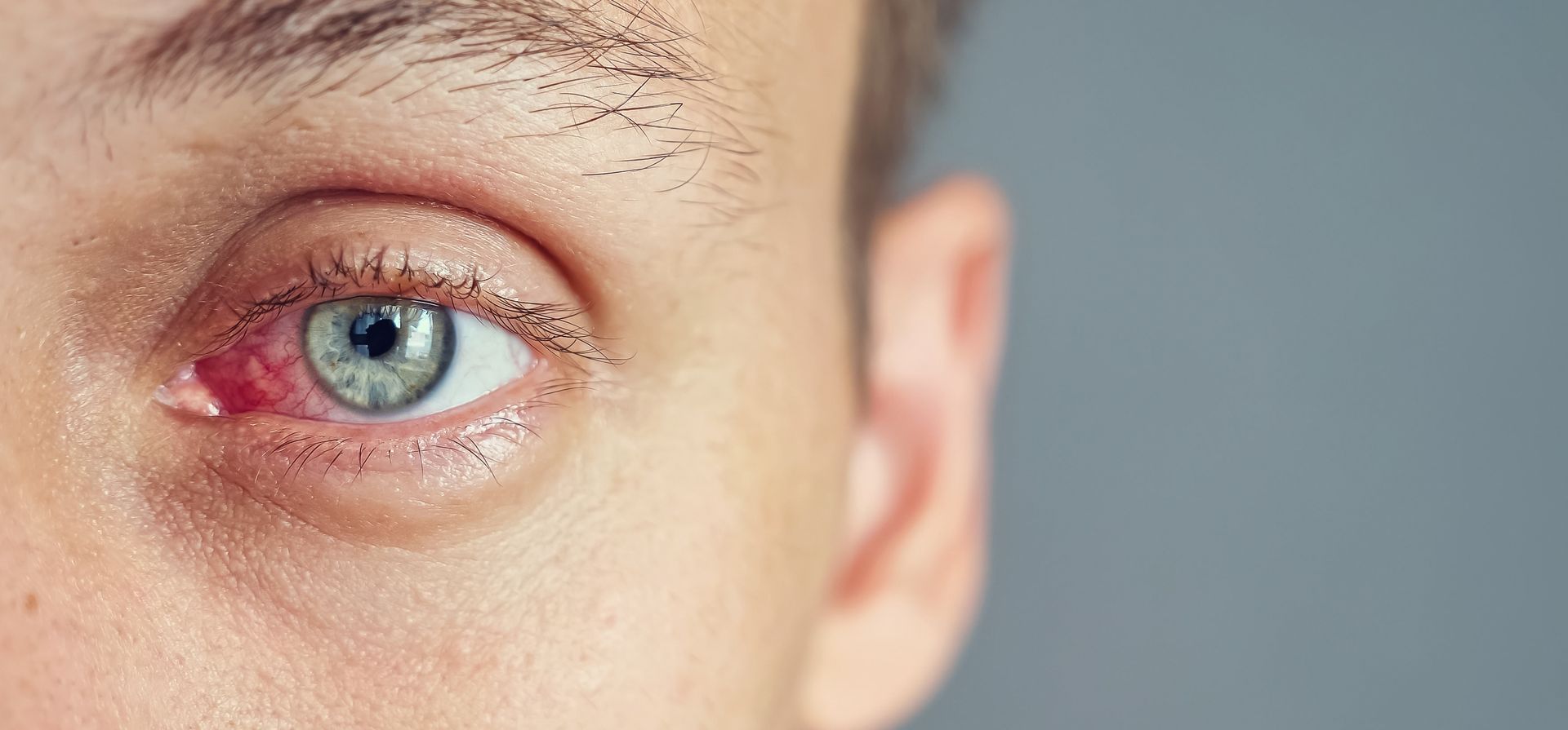 Ojo Seco, una mirada al  problema y a las últimas  tecnologías disponibles