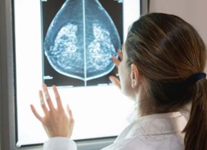 Presentan un prometedor fármaco para un tipo de cáncer de mama metastásico