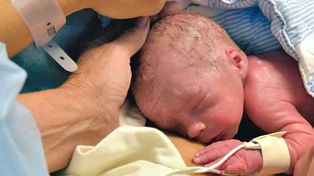 En Suecia nació el primer bebé de madre con útero trasplantado