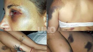 San Carlos Centro: brutal intento de femicidio y marcha pidiendo justicia