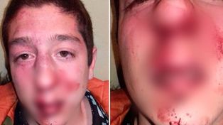 Insólito: patovicas le pegaron por error y le dieron entradas gratis como disculpas