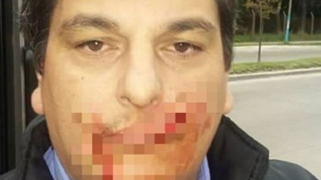 Le cortaron la cara a un colectivero con un machete