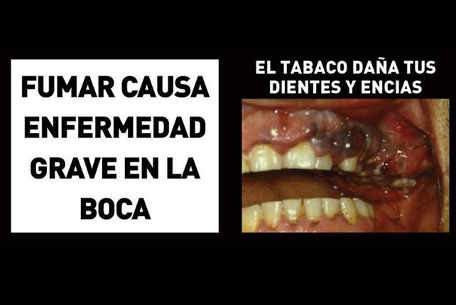 Nuevas etiquetas contra el tabaquismo