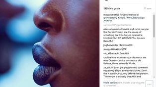 Los labios más polémicos de Instagram