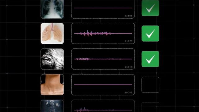Muestra de HeAR de Google