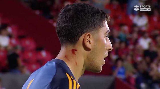El corte en el cuello del arquero de Boca Leandro Brey