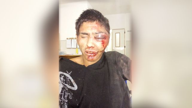 Vecinos le dieron una brutal golpiza a un ladrón que le quiso robar el celular a una nena