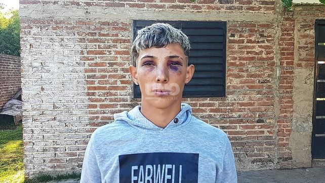 Alejandro fue agredido en un boliche de la Ruta Nacional 168.