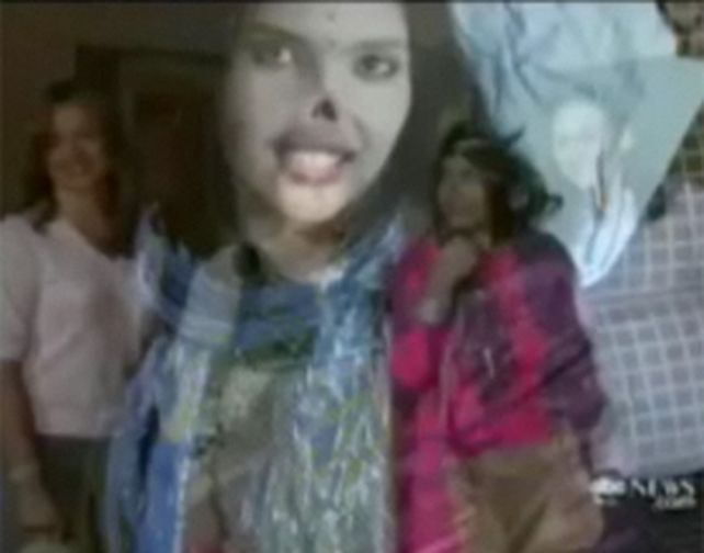 Aisha, la chica afgana mutilada por su esposo, recuper&oacute; su nariz y su sonrisa. (Video)