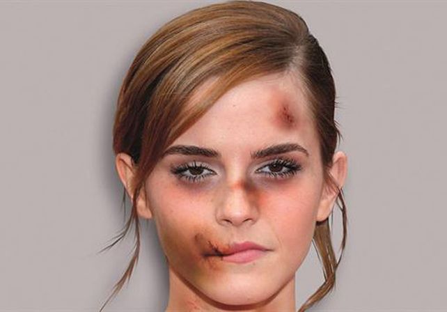 Famosas ponen la cara a una campaña contra la violencia de género