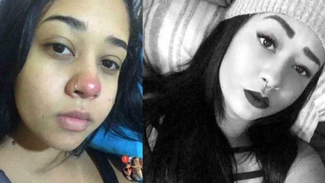 Layane Dias comenzó a sentir dolores insoportables. Le salvaron la vida