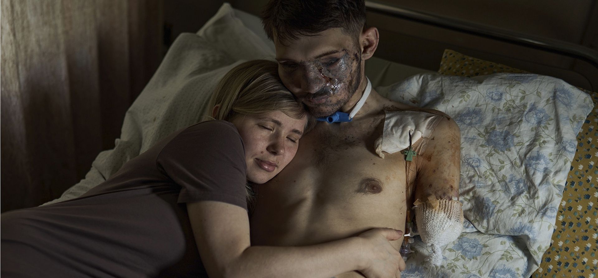 Alina, abraza a su esposo Andriy en un hospital en Kiev, Ucrania, el lunes 10 de julio de 2023. Andriy es un oficial de reconocimiento aéreo de la brigada 47 del ejército ucraniano, cuyo nombre en clave es Apóstol, que resultó gravemente herido en una batalla con las tropas rusas en el región de Zaporizhzhia. (Foto AP/Libkos)