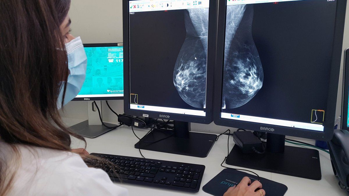 During the pandemic, 80% fewer mammograms and 60% fewer Pap smears were done