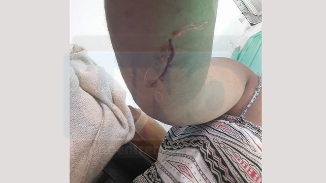 La hija también fue agredida y terminó herida.&nbsp;