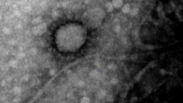 La primera foto del coronavirus que circula por Argentina
