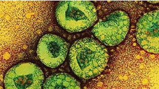 Alerta por la aparición de otro virus del síndrome respiratorio severo