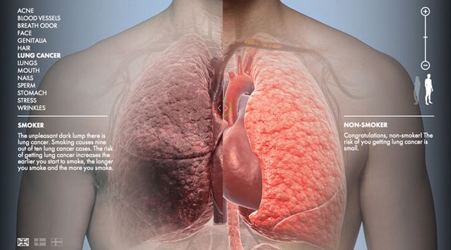 Impactante campaña contra el cigarrillo: así te queda el cuerpo si fumás